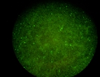 Tollwut (Immunfluoreszenz-Nachweis)